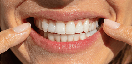 Patient 2 after treatment