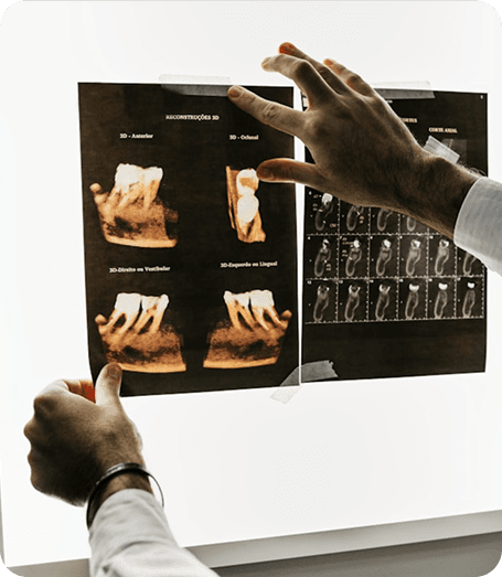 Dental X-ray films held up to the light