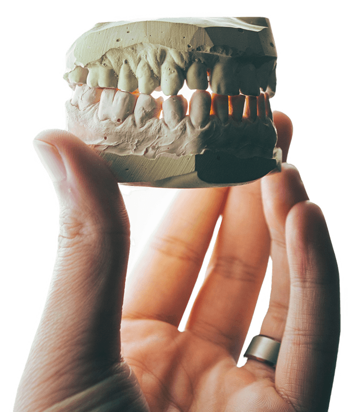 Dental model held in hand